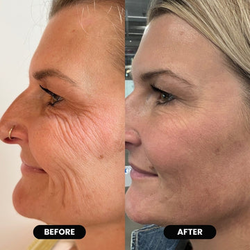 Vitae Charm ExoVita Essence (Exosomes)