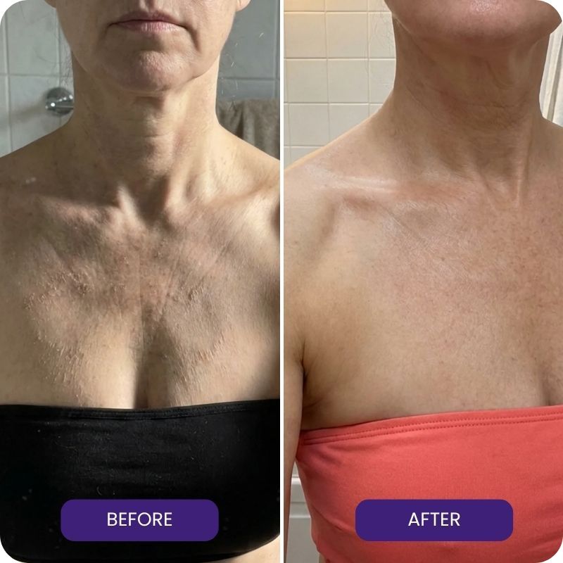 #1 Hypothyroidism skin (2).jpg__PID:a6d7d82e-5f7a-4bf9-ac16-9eb2f51306d1