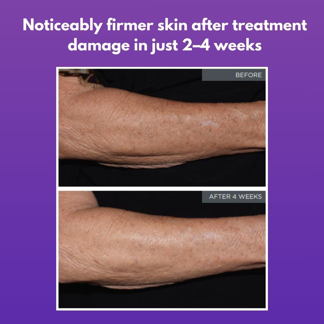 Vitae Charm Body Oil For Cancer Survivors