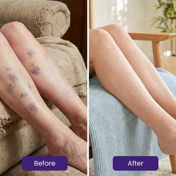 Vitae Charm Body Oil for Bruising Skin