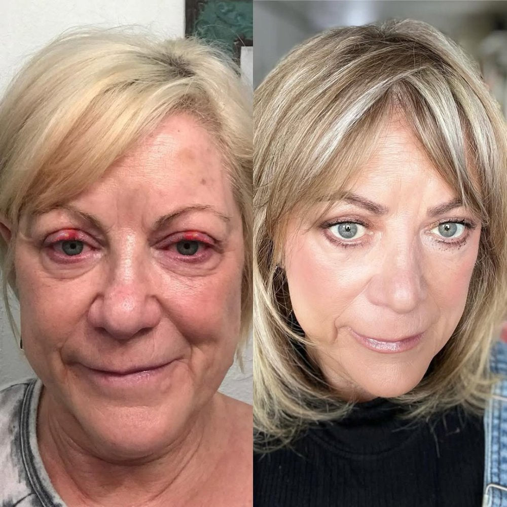 Vitae Charm ExoVita Essence - Eye Area Damage.