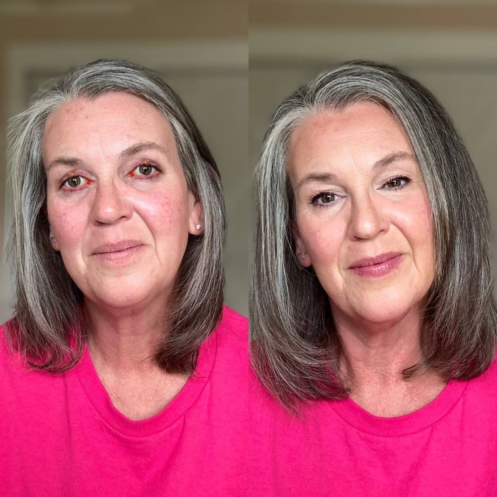 Vitae Charm ExoVita Essence - Eye Area Damage.