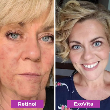 Vitae Charm ExoVita Essence